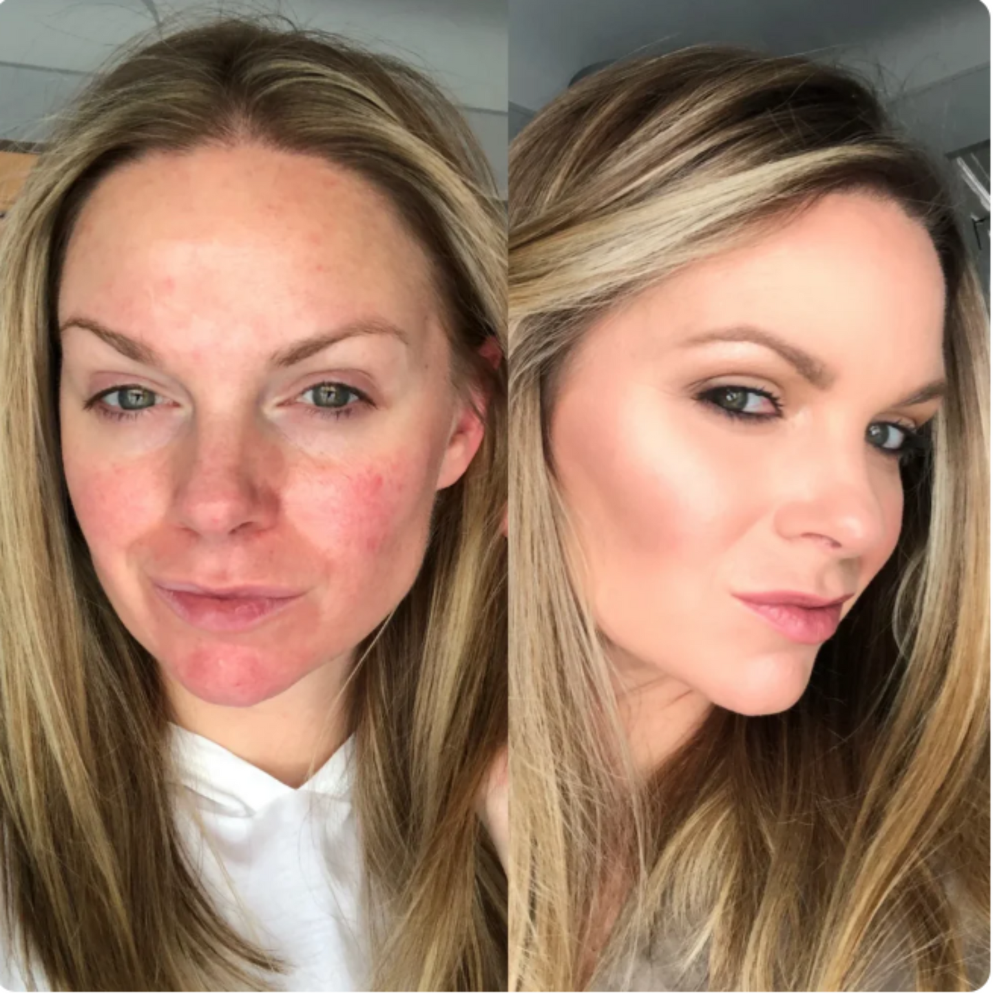 EVORA - Tu rutina 4 en 1 para una piel perfecta